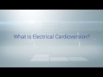 What is Electrical Cardioversion?